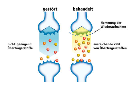 Grafik Synapsen